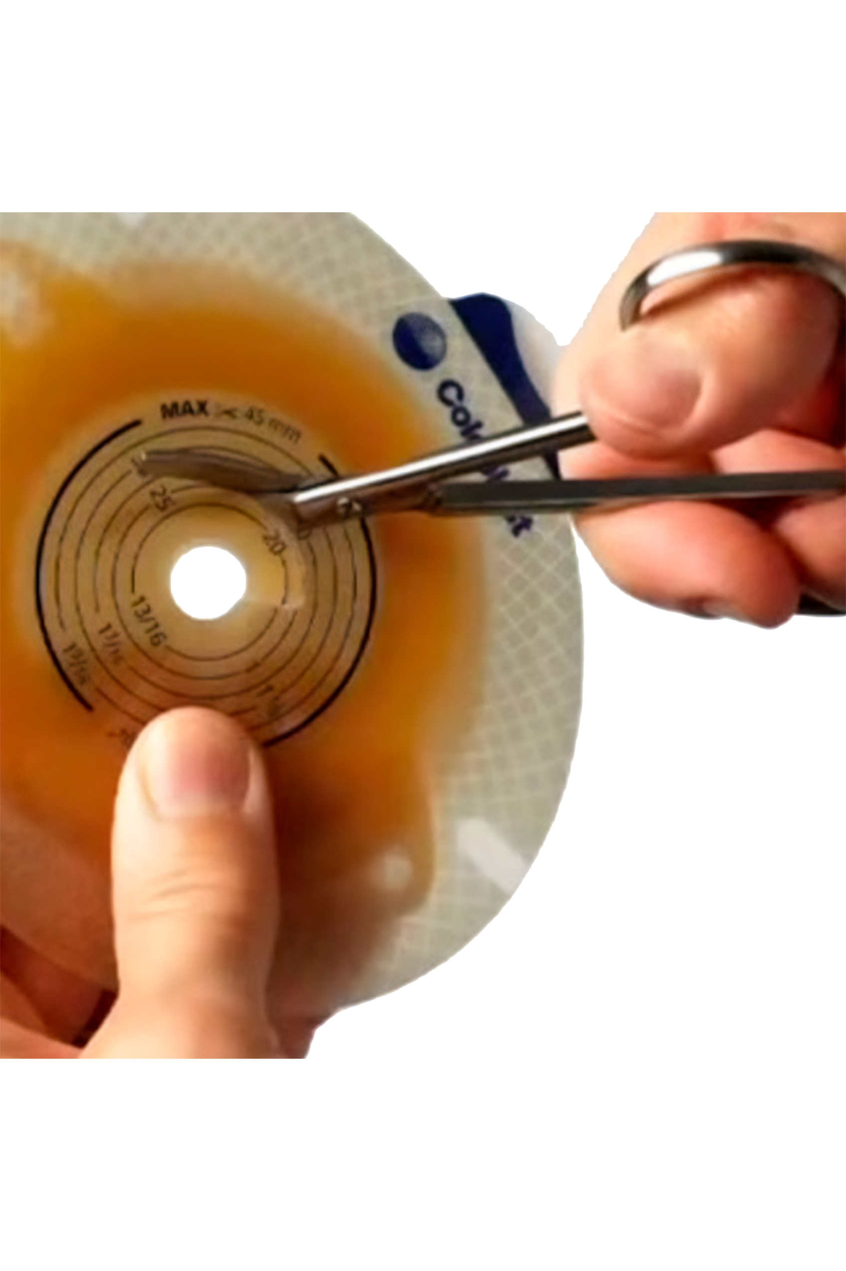 Enfermania Instrumental Ostomía ciseaux stomie 10,5 cm